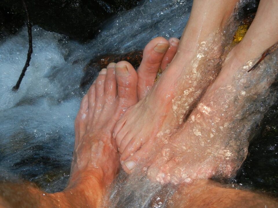 Micose das uñas das pernas